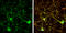 Protein Phosphatase 3 Regulatory Subunit B, Alpha antibody, GTX114181, GeneTex, Immunocytochemistry image 