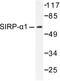 Signal Regulatory Protein Alpha antibody, LS-C176208, Lifespan Biosciences, Western Blot image 