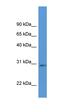 Ribose 5-Phosphate Isomerase A antibody, orb325993, Biorbyt, Western Blot image 