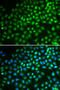 SWI/SNF Related, Matrix Associated, Actin Dependent Regulator Of Chromatin, Subfamily A, Member 5 antibody, STJ25614, St John