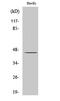SPT3 Homolog, SAGA And STAGA Complex Component antibody, GTX34243, GeneTex, Western Blot image 