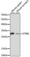 Chymotrypsinogen B1 antibody, GTX66324, GeneTex, Western Blot image 