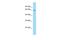 Beta-1,4-N-Acetyl-Galactosaminyltransferase 2 antibody, PA5-70775, Invitrogen Antibodies, Western Blot image 