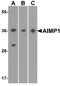 Aminoacyl TRNA Synthetase Complex Interacting Multifunctional Protein 1 antibody, A03109, Boster Biological Technology, Western Blot image 