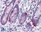Vitamin D Receptor antibody, LS-B2976, Lifespan Biosciences, Immunohistochemistry frozen image 