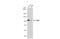 Oxysterol Binding Protein antibody, NBP2-15056, Novus Biologicals, Western Blot image 