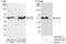 Eukaryotic Translation Initiation Factor 3 Subunit E antibody, A302-985A, Bethyl Labs, Western Blot image 