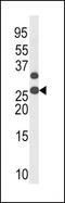 Cyclin Dependent Kinase Inhibitor 1B antibody, PA5-12651, Invitrogen Antibodies, Western Blot image 