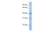 Thioredoxin Domain Containing 15 antibody, A16101, Boster Biological Technology, Western Blot image 