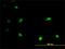 Iroquois Homeobox 3 antibody, H00079191-M03, Novus Biologicals, Immunocytochemistry image 