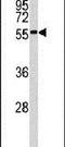 MAP kinase-interacting serine/threonine-protein kinase 2 antibody, PA5-13953, Invitrogen Antibodies, Western Blot image 