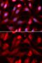 SMAD Family Member 4 antibody, GTX32880, GeneTex, Immunofluorescence image 