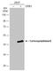 Carboxypeptidase B1 antibody, NBP2-15698, Novus Biologicals, Western Blot image 