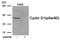 Cyclin D1 antibody, 80-035, ProSci, Western Blot image 
