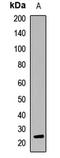 Interleukin-29 antibody, LS-C668939, Lifespan Biosciences, Western Blot image 