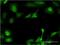 UDP-GlcNAc:BetaGal Beta-1,3-N-Acetylglucosaminyltransferase 3 antibody, MA5-21011, Invitrogen Antibodies, Immunofluorescence image 