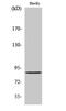 Protein Kinase CGMP-Dependent 2 antibody, A05103, Boster Biological Technology, Western Blot image 