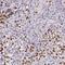 Lysine Demethylase 1A antibody, FNab04508, FineTest, Immunohistochemistry paraffin image 