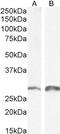 Snail Family Transcriptional Repressor 1 antibody, GTX89239, GeneTex, Western Blot image 