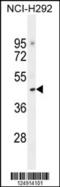 Tight Junction Associated Protein 1 antibody, 55-400, ProSci, Western Blot image 