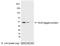 AU5 epitope tag antibody, A190-126A, Bethyl Labs, Western Blot image 