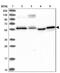 PPARG Related Coactivator 1 antibody, NBP1-82985, Novus Biologicals, Western Blot image 
