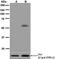 SRC Proto-Oncogene, Non-Receptor Tyrosine Kinase antibody, GTX63902, GeneTex, Western Blot image 