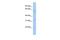 TRNA Methyltransferase 61B antibody, GTX46187, GeneTex, Western Blot image 