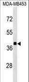 Aldolase, Fructose-Bisphosphate B antibody, LS-C161035, Lifespan Biosciences, Western Blot image 