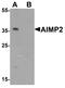 Aminoacyl TRNA Synthetase Complex Interacting Multifunctional Protein 2 antibody, LS-C201145, Lifespan Biosciences, Western Blot image 