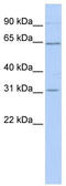 Solute Carrier Family 27 Member 2 antibody, TA333990, Origene, Western Blot image 