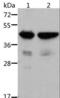 Actin Alpha 1, Skeletal Muscle antibody, LS-C404497, Lifespan Biosciences, Western Blot image 