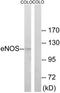 Nitric oxide synthase, endothelial antibody, TA314269, Origene, Western Blot image 