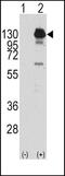 Platelet Derived Growth Factor Receptor Alpha antibody, PA5-14709, Invitrogen Antibodies, Western Blot image 