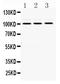 RAS P21 Protein Activator 1 antibody, PB9796, Boster Biological Technology, Western Blot image 