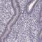 Chromosome 10 Open Reading Frame 62 antibody, PA5-67264, Invitrogen Antibodies, Immunohistochemistry paraffin image 