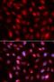 Small Ubiquitin Like Modifier 2 antibody, LS-C332176, Lifespan Biosciences, Immunofluorescence image 