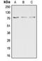 Dual Specificity Phosphatase 16 antibody, orb215305, Biorbyt, Western Blot image 