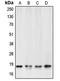 Caspase 6 antibody, LS-C351923, Lifespan Biosciences, Western Blot image 