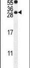 Protein Phosphatase 1 Regulatory Inhibitor Subunit 14C antibody, PA5-23660, Invitrogen Antibodies, Western Blot image 