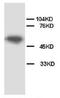 Apoptosis Inhibitor 5 antibody, AP23281PU-N, Origene, Western Blot image 