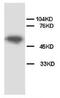 Apoptosis Inhibitor 5 antibody, AP23281PU-N, Origene, Western Blot image 