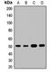 Integrin Linked Kinase antibody, orb411627, Biorbyt, Western Blot image 