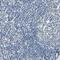 ArfGAP With Dual PH Domains 1 antibody, HPA012049, Atlas Antibodies, Immunohistochemistry paraffin image 