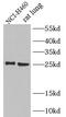 IL-6 antibody, FNab04282, FineTest, Western Blot image 