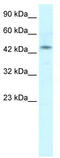 Iroquois Homeobox 2 antibody, TA330191, Origene, Western Blot image 