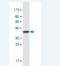 Oxysterol Binding Protein Like 7 antibody, H00114881-M03, Novus Biologicals, Western Blot image 