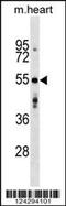 Glycerol-3-Phosphate Acyltransferase 3 antibody, 59-592, ProSci, Western Blot image 