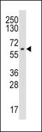 Cytochrome P450 Family 19 Subfamily A Member 1 antibody, PA5-14175, Invitrogen Antibodies, Western Blot image 