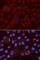 X-Ray Repair Cross Complementing 3 antibody, A2134, ABclonal Technology, Immunofluorescence image 
